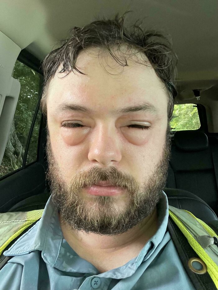 Hombre con ojos hinchados y expresión agotada sentado en un auto mostrando señales de tener un mal día.