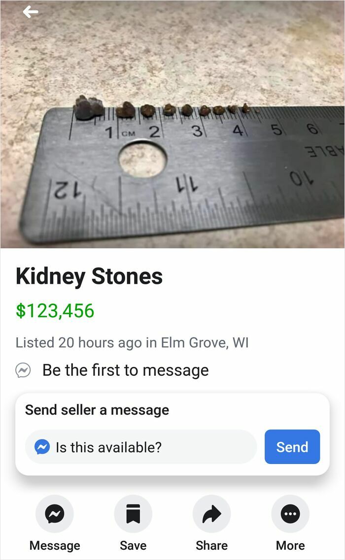Kidney stones placed on a ruler, listed at a high price on Facebook Marketplace.