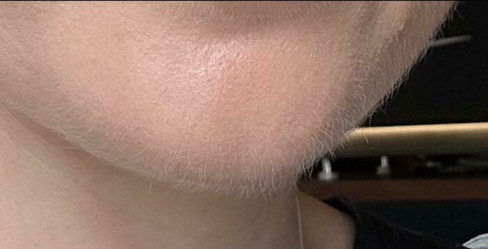 Close-up of a person's chin showing facial hair, highlighting beauty standards in grooming trends.