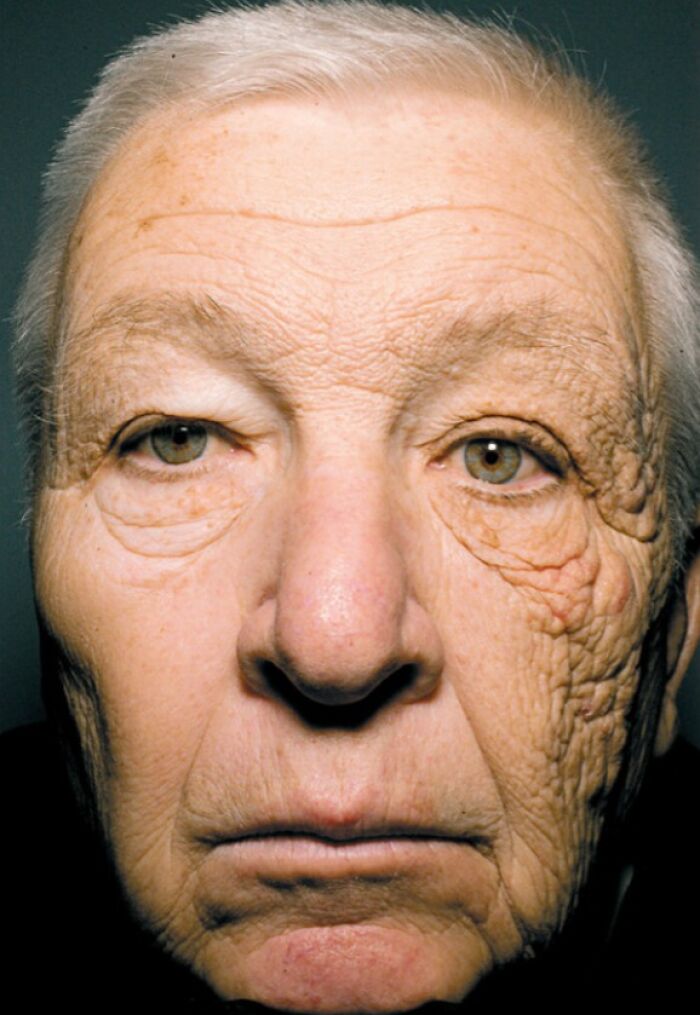 Close-up of an elderly face, showcasing wrinkles as a transformation by time and use.