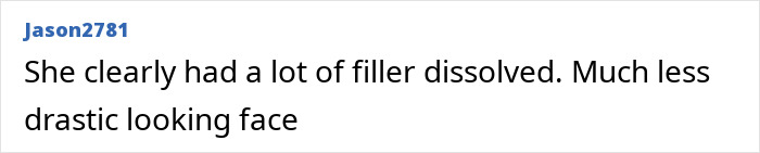 Comment discussing Madonna's smooth face and reduced fillers.