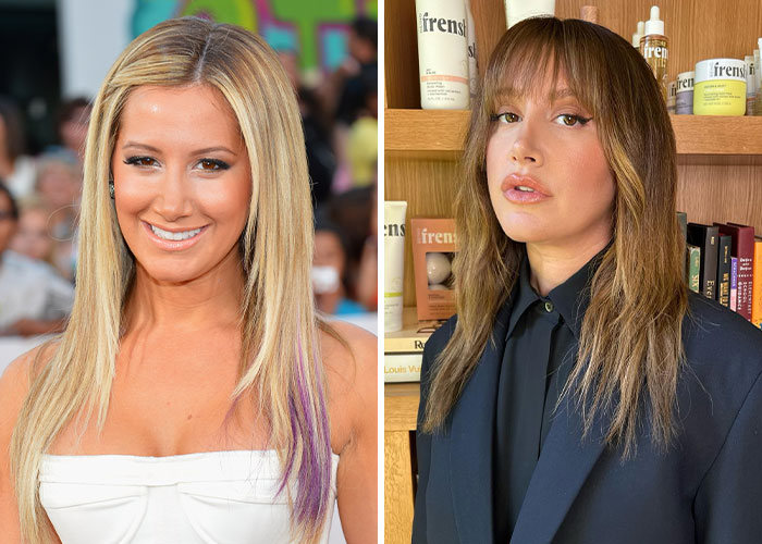 Two images of a woman before and after plastic surgery, showcasing changes in her appearance.