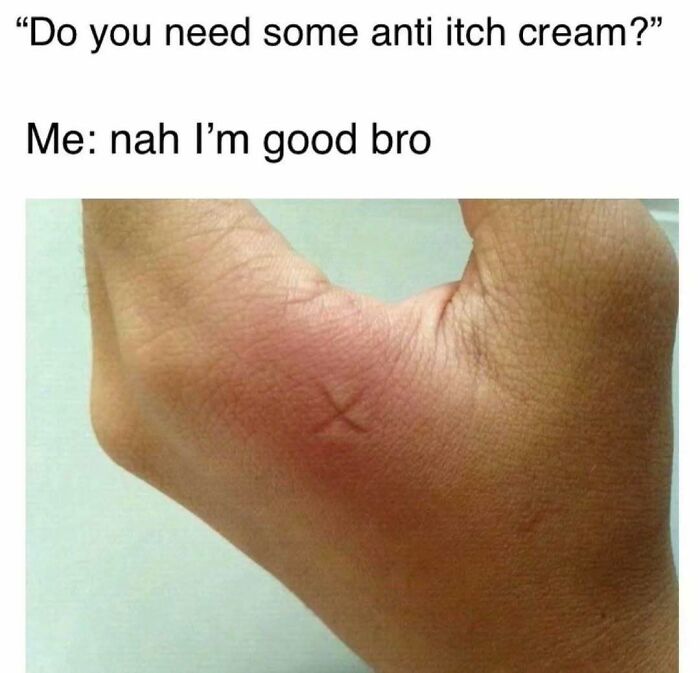 Swollen hand with humor text, typical amusing meme from Diary Introverts.