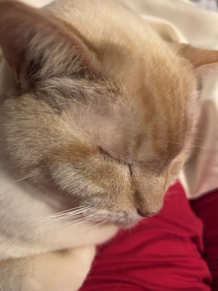 Giving Me Comfort After My 16th Surgery. He Never Leaves My Side When I’m In Pain