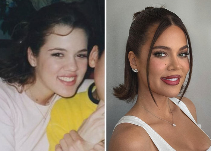 Before and after images of a celebrity discussing plastic surgery regrets, smiling and posed differently.