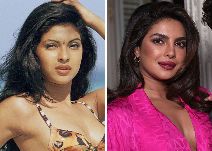 Two side-by-side images of a woman before and after plastic surgery.