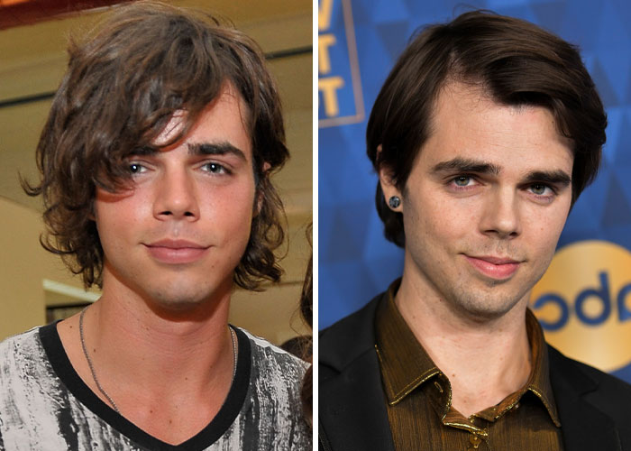 Two side-by-side images showing a person before and after plastic surgery regret, with different hairstyles and outfits.