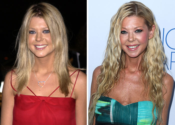 Two images of a celebrity, one before and one after plastic surgery, highlighting regret over the changes.