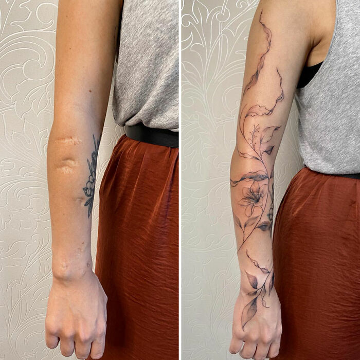 Arm scars transformed into beautiful floral tattoos.