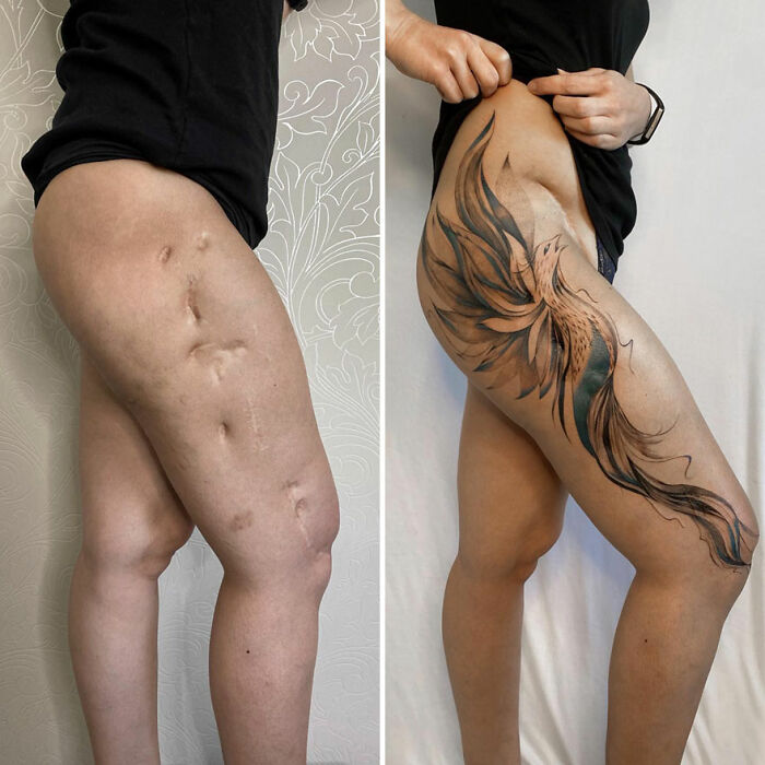 Before and after of a scar covered by a floral tattoo, showcasing an artist’s skill in transforming scars into art.