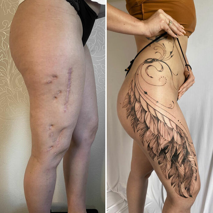 Before and after of a leg scar beautifully transformed into a tattoo design by an artist.