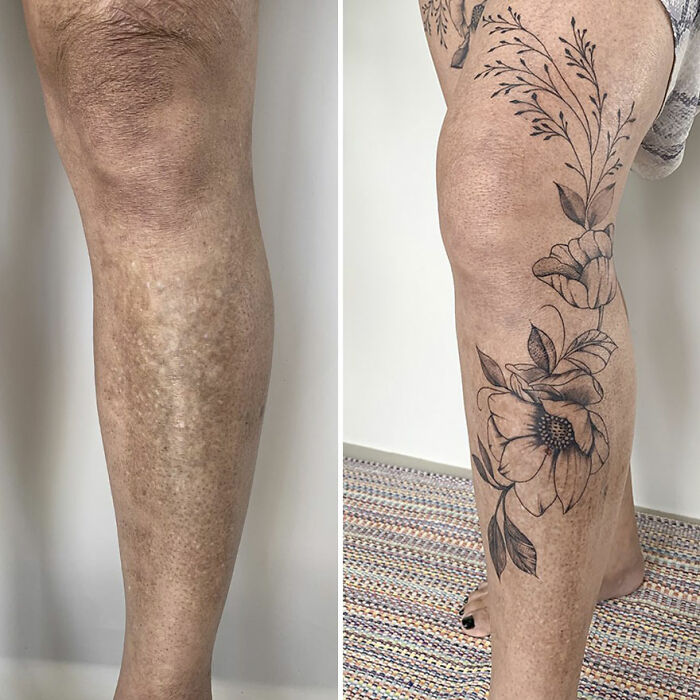 Leg scar transformed into floral tattoo art, showcasing confidence through tattoos.