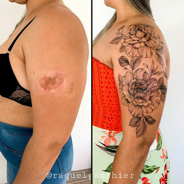Before and after image of a scar transformed into a floral tattoo, highlighting beauty in tattoos.