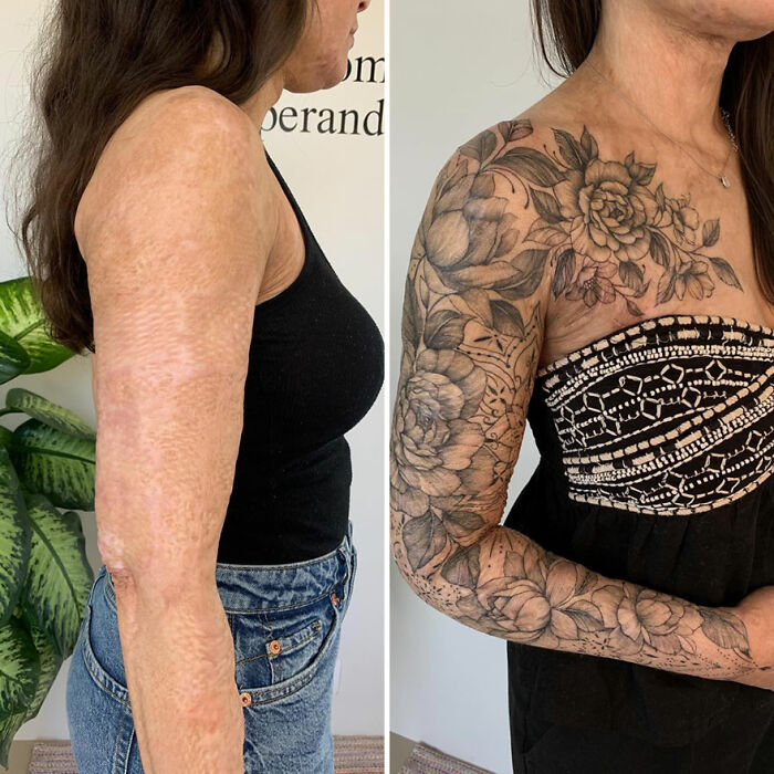 Woman's scar beautifully transformed into floral tattoo art on her arm.