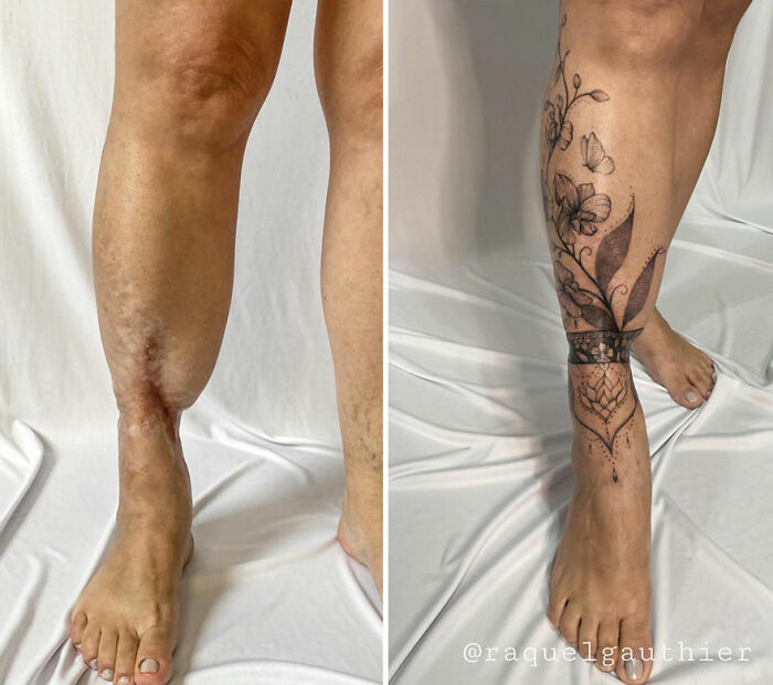 Before and after of a leg scar transformed into beautiful tattoo art by an artist.