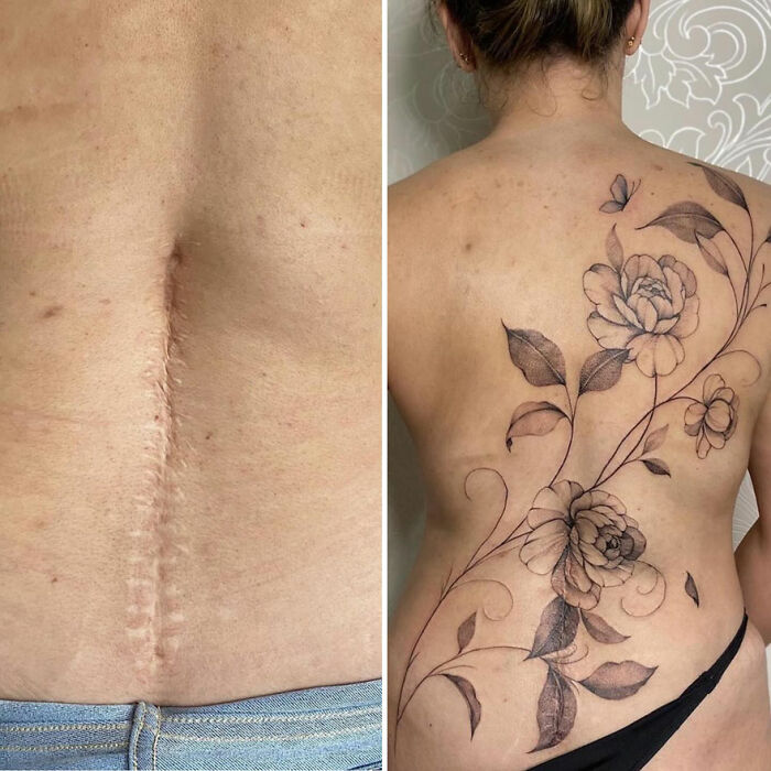 Before and after of a back scar transformed into a floral tattoo, showcasing art that reclaims confidence.
