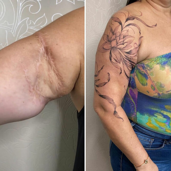 Scar cover-up tattoo with a floral design on a woman's arm, highlighting confidence transformation through artistry.