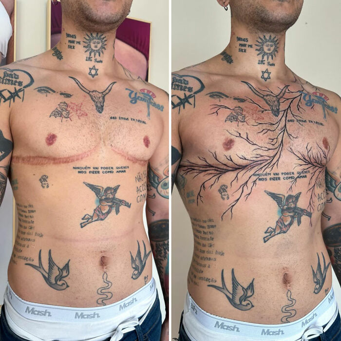 Man with chest tattoos transforming scars into art with tree design.