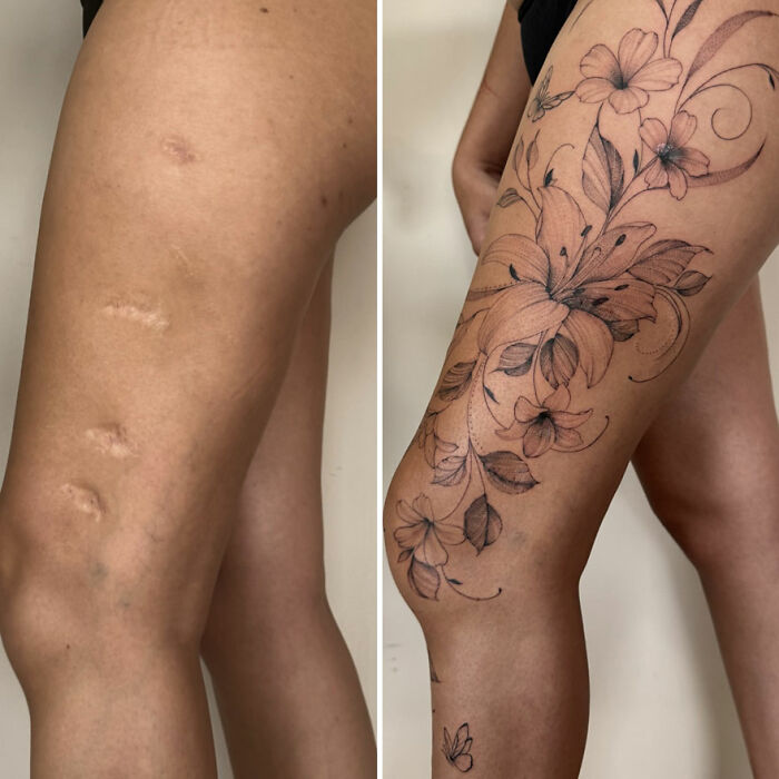 Before and after of scar turned into a beautiful floral tattoo, showcasing artistic transformation and confidence reclamation.