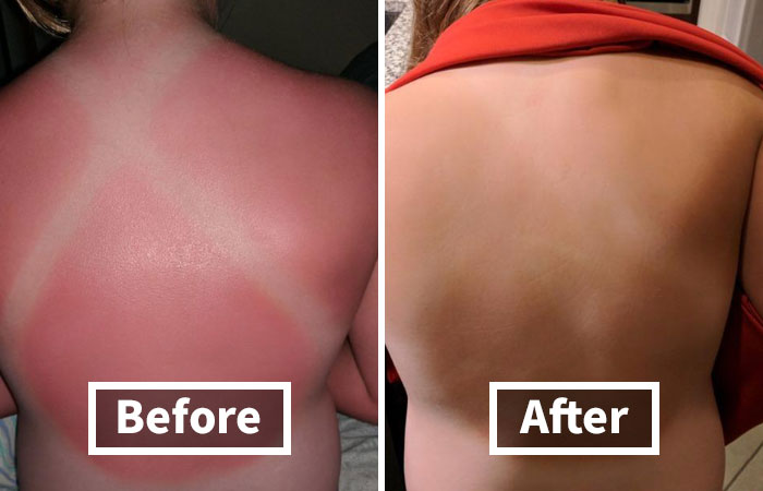 Before and after images show skin improvement; essential spring essentials impact.