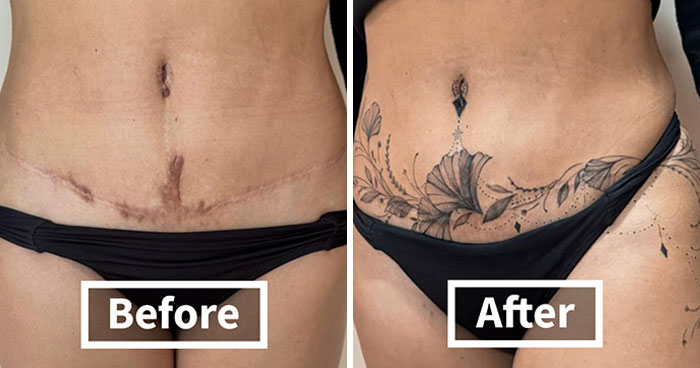 Tattoo Artist Covers Scars With Delicate Designs, And Here Are Her 30 Best Transformations