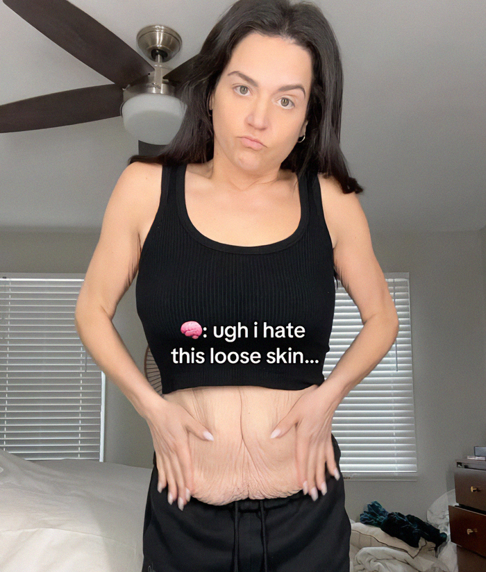 Woman shows excess skin from Ozempic transformation, unhappy expression, wearing a black tank top in a bedroom.