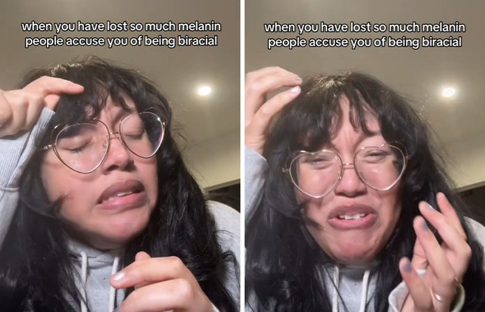 Natasha Allen with glasses discussing melanin loss impacts in two emotional video frames.