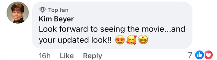 Kim Beyer comments on a drastic facial makeover, expressing excitement with emojis.