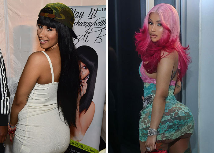 Woman in two images; before and after plastic surgery transformation.