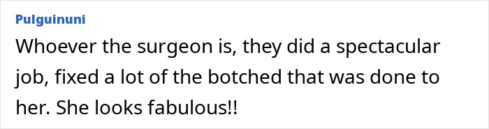 Comment praising Madonna's smooth face, stating she looks fabulous after surgery fixes.