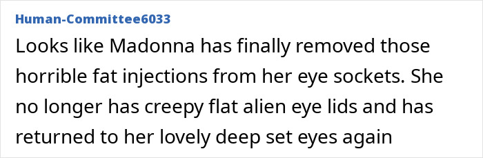 Madonna's face appears smoother, suggesting a reduction in facial fillers, with fans commenting on her eye appearance.