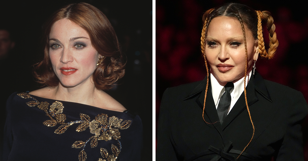 20 Celebridades que se arrepintieron de hacerse cirugía plástica por sus brutales efectos