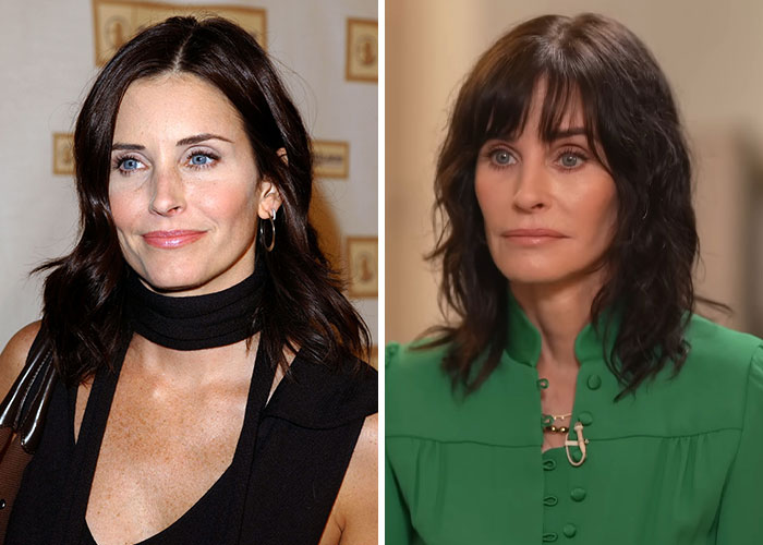 Two images of the same celebrity showing different appearances, possibly related to plastic surgery regret.