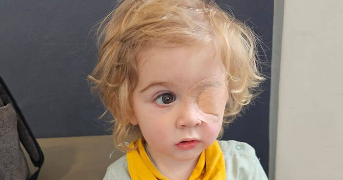 “Horrific!”: Toddler At Risk Of Losing His Eye After Being Kissed By Someone With Herpes Virus