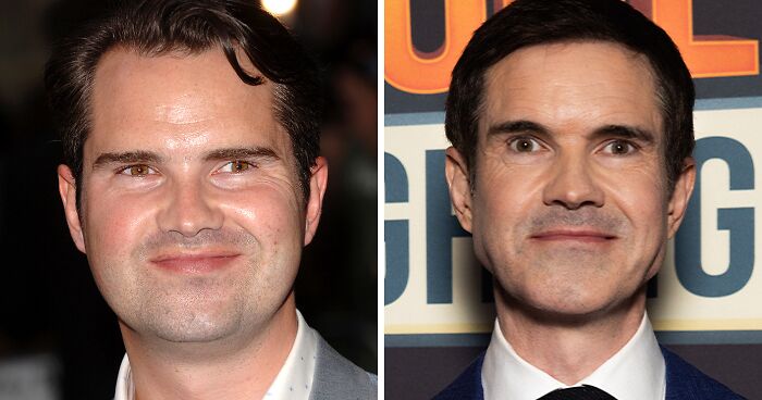 “He’s Aged 20 Years”: Jimmy Carr Admits He Can’t Stop Getting Cosmetic “Tweakments”