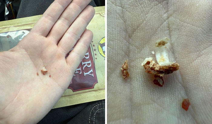 Pieces of bone found in food, held in a person's hand, highlighting a disgusting food discovery experience.