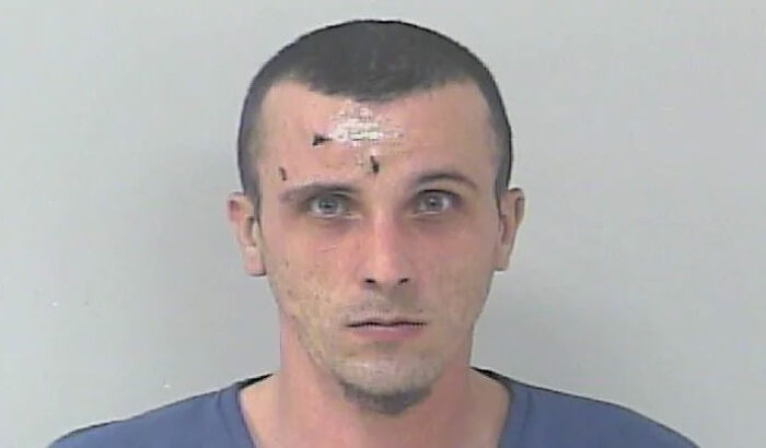 Man with stitches on forehead in mugshot, related to crazy Florida man stories.