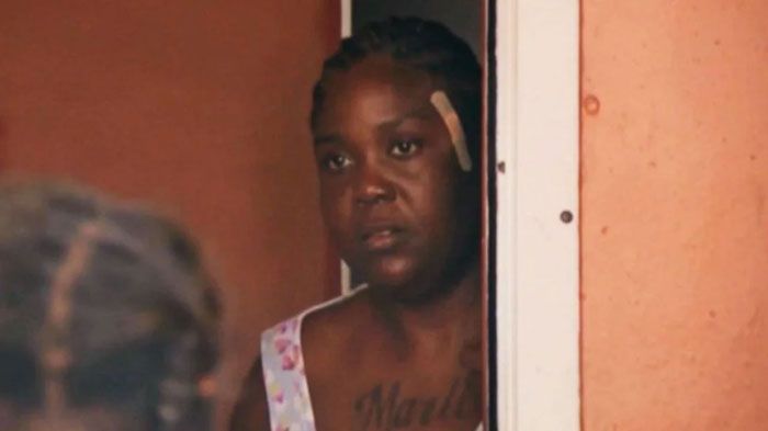 Woman at a door, wearing a floral dress with a bandage on her face, embodying a moment from a Florida man story.