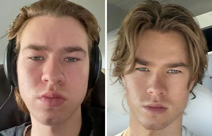 Vain man transforms with techniques, before and after photos show dramatic 'supermodel' change.