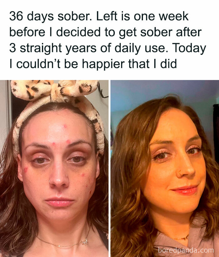 Before and after photos of a woman's 36-day sobriety journey, showing a positive transformation.