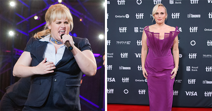 “Horrible Side Effects”: Experts Warn About Hollywood’s Ozempic Obsession