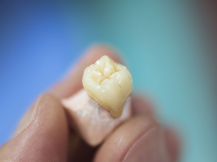 Close-up of a tooth model held between fingers, related to husband's prank.