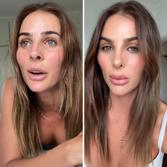 Woman defends rhinoplasty results, showcasing before and after photos.
