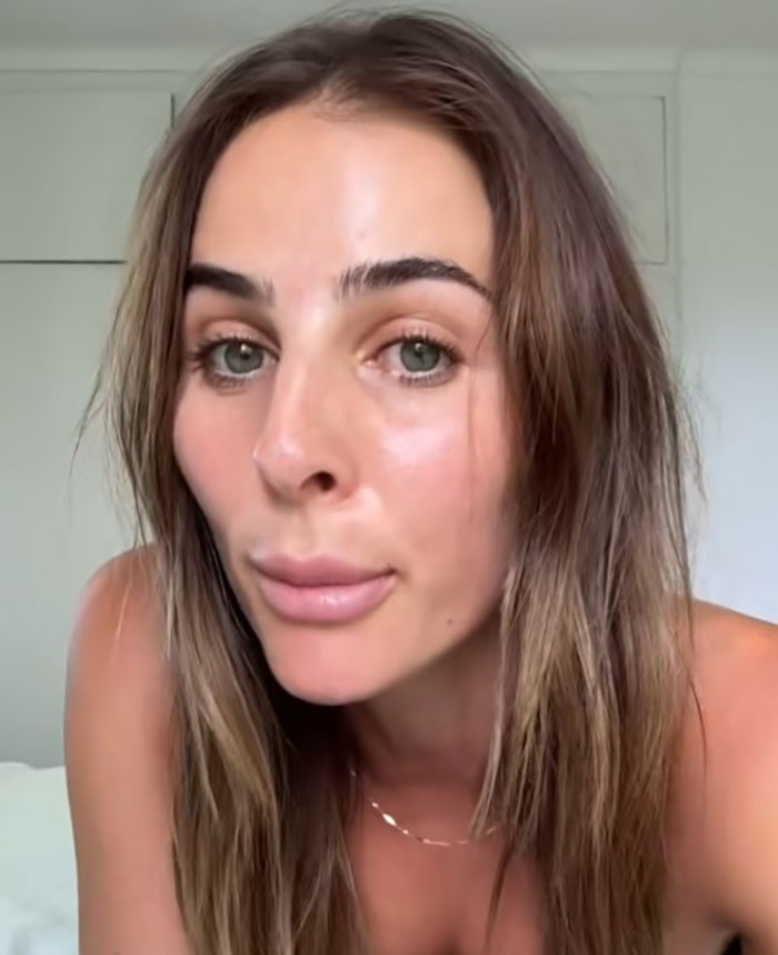 Woman showing rhinoplasty results with straight hair in a bright room.