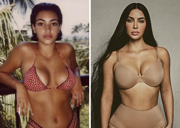 Two images of a woman, highlighting changes possibly linked to plastic surgery regrets.