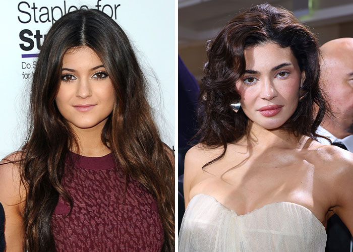 Two images of a celebrity, highlighting plastic surgery regret.