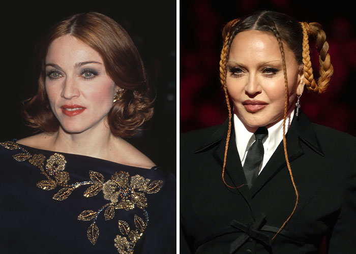 Celebs and plastic surgery: a woman in elegant attire on the left; the same woman with braided hairstyle on the right.