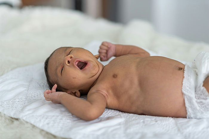 Yawning baby lying on a soft blanket, embodying unforgettable coincidences and serene moments.