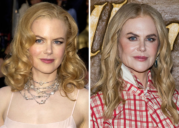 Two images of a person with blonde hair; one in a light dress, the other in a red plaid shirt, discussing plastic surgery regrets.