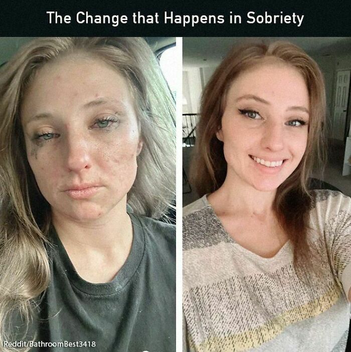 Two-photo comparison showing positive change in sobriety journey; person appears healthier and happier.